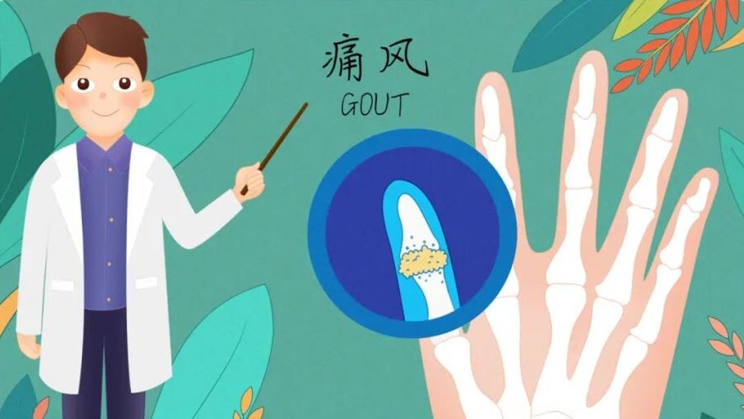 张本智和模仿樊振东模仿姆巴佩